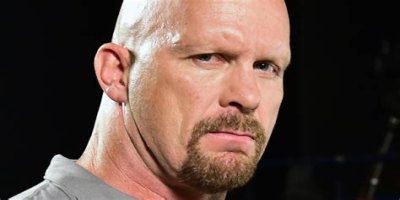 Unveiling The Truth: Steve Austin's Baldness Decoded